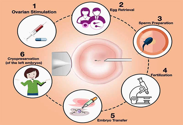 gynaecology-infertility
